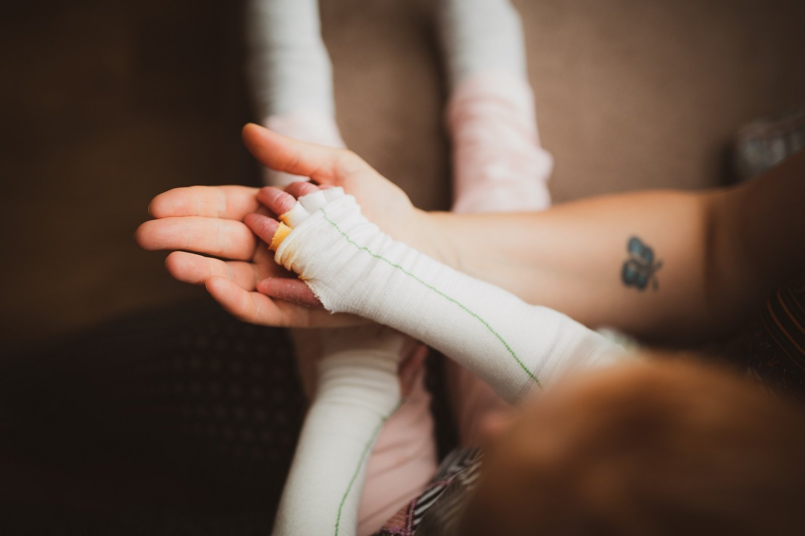 How DEBRA Ireland Make Life a Little Better for Children and Families Battling EB